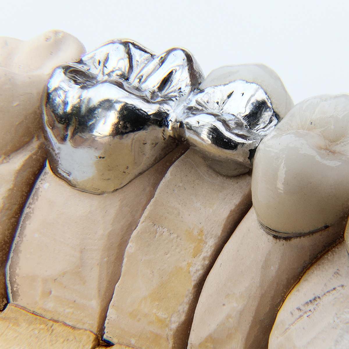 micro-welding-industry-dental2 micro-welding-industry-dental2